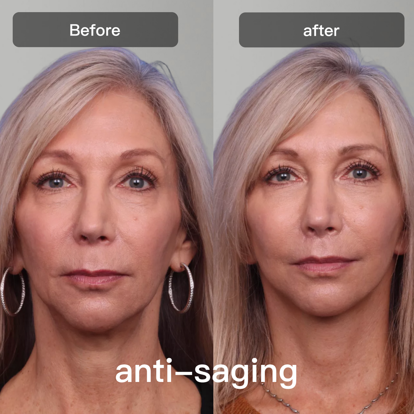 DermalGlow™ 7X – At-Home LED Light Therapy Lamp