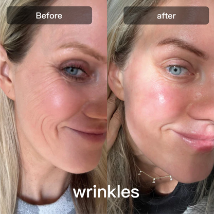 DermalGlow™ 7X – At-Home LED Light Therapy Lamp