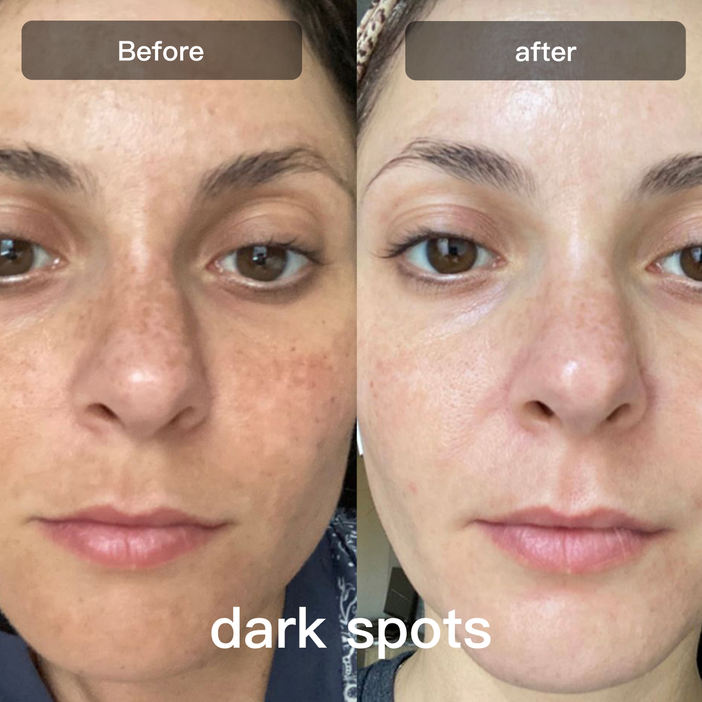 DermalGlow™ 7X – At-Home LED Light Therapy Lamp