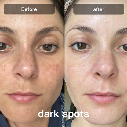 DermalGlow™ 7X – At-Home LED Light Therapy Lamp