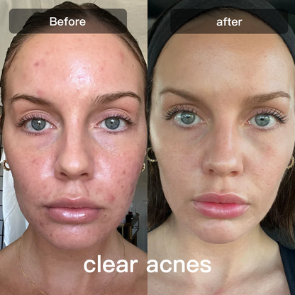 DermalGlow™ 7X – At-Home LED Light Therapy Lamp